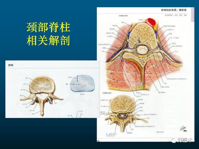 颈椎病的mri诊断技巧!