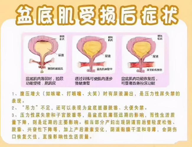 产后修复师提醒:如果出现这样的症状,预示着盆底肌松弛找上你了