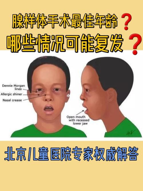 交作业75专家解答之94腺样体肥大_腺样体_首都医科大学附属北京