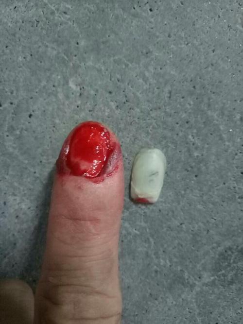 指甲出血_图客网 - 电脑桌面壁纸,高清桌面壁纸,电脑主题,手机屏保