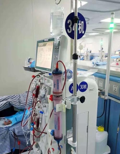 新技术景德镇市第三人民医院血液净化中心成功开展双腔血液透析滤过