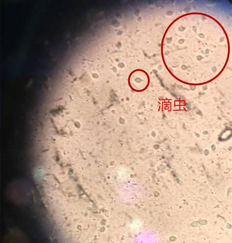 在显微镜下,这两种寄生虫是这样的