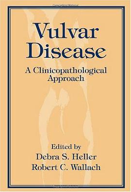 vulvar disease