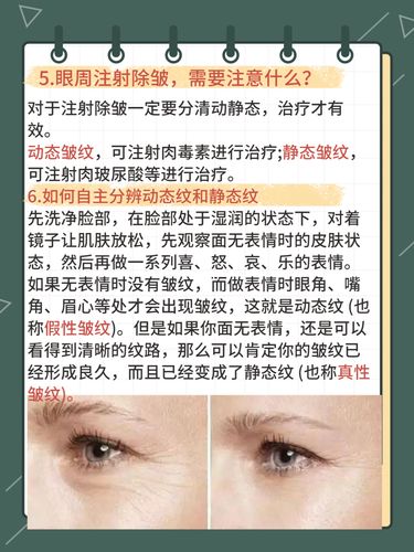 75眼袋眼沟眼周皱纹,史上最全最详细攻略_眼袋_教程