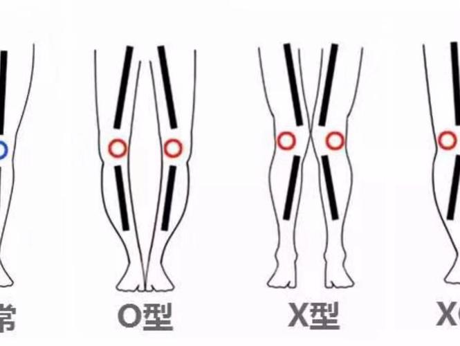 xo腿型改善计划
