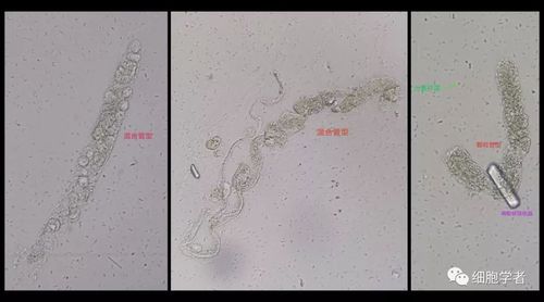 主要来源:[手绘图]刘书耀,[镜下图]朱红刚.