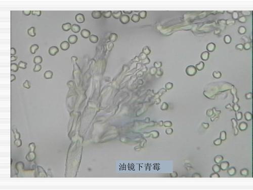 实验四,霉菌的形态观察ppt