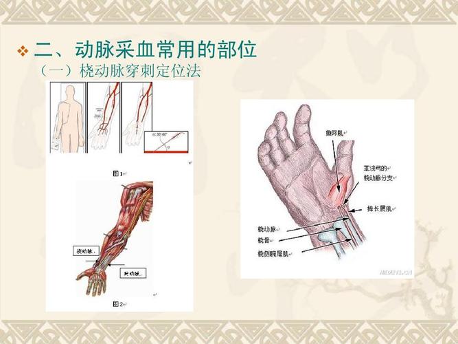 二,动脉采血常用的部位 (一)桡动脉穿刺定位法