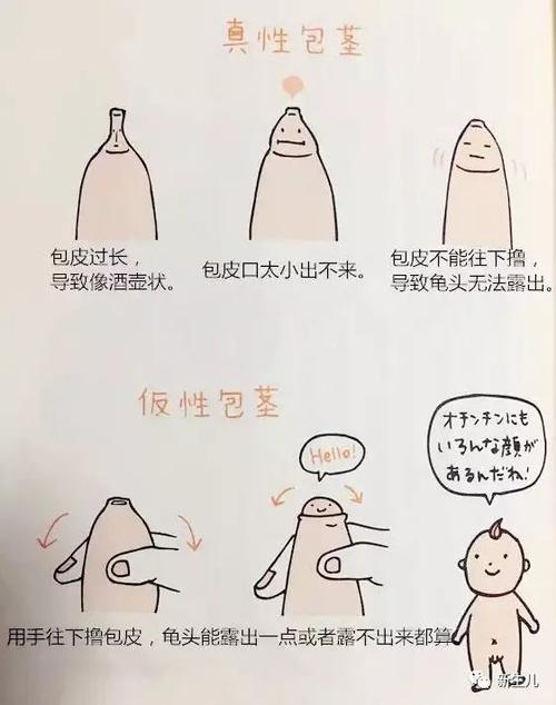 新生儿:如何清洗小鸡鸡