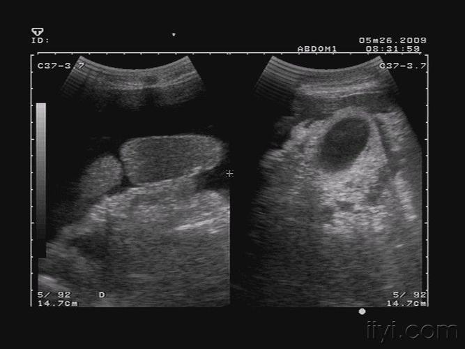 这个脾是怎么回事