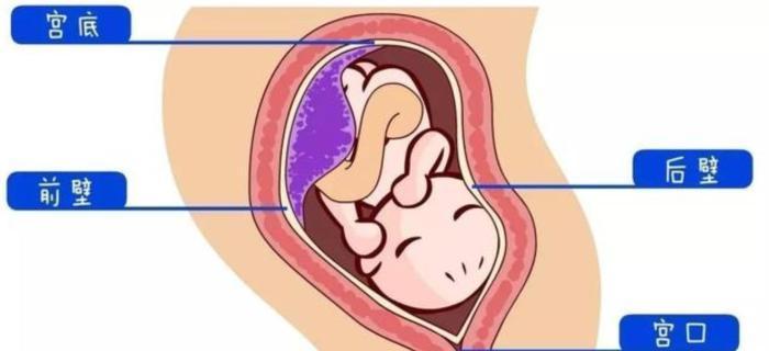 到底是"前壁好生"还是"后壁好生"啊?