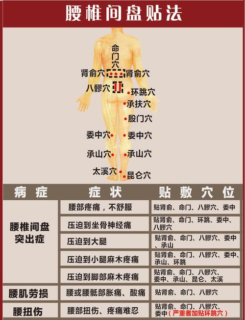 腰椎间盘突出绒布峰针膏药穴位贴法