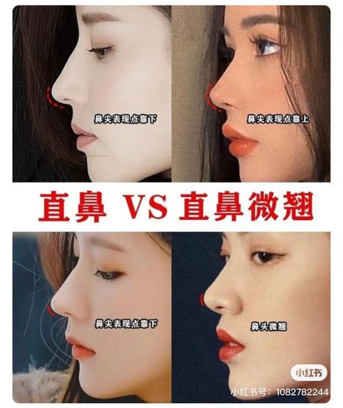 直鼻 or 微翘鼻功课7515你到底适合哪一种71_鼻