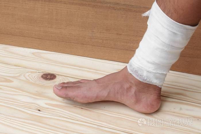 纱布绷带的医师脚踝受伤的治疗情况
