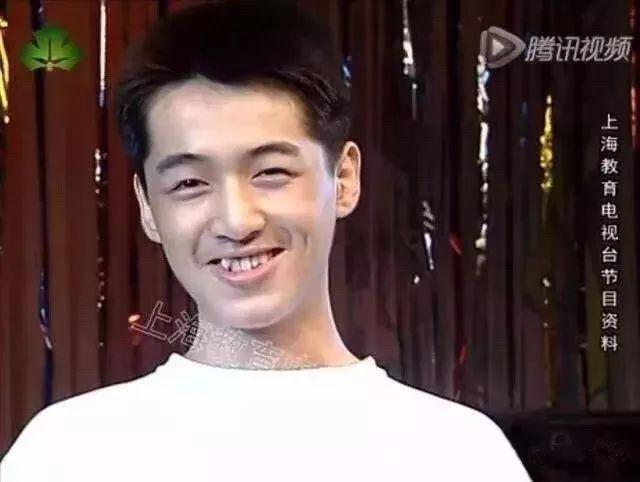 再精致的脸也挡不住一口乱牙,李云迪胡歌摘牙套前后判若两人
