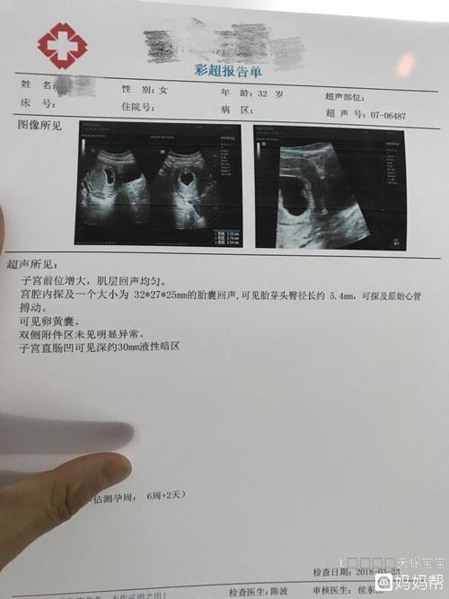 这是标准的女孩胎囊啊