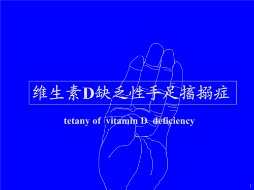 维d缺乏性手足搐搦症课件.ppt