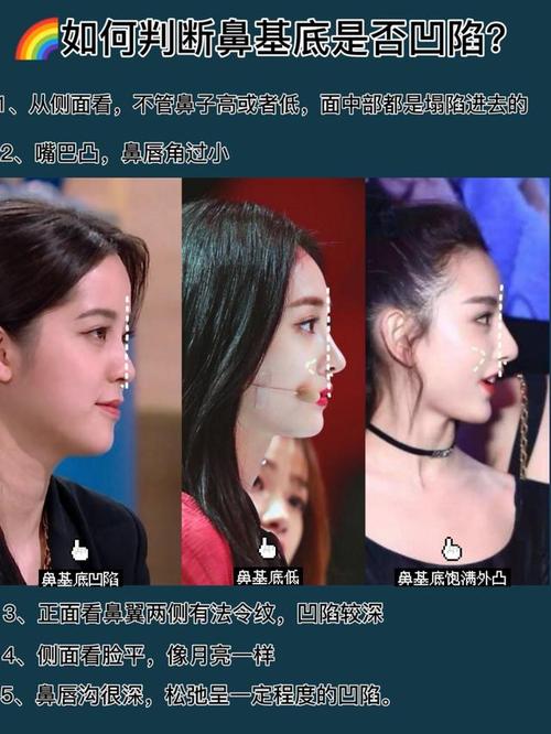 侧脸太虐快来测测是不是鼻基底凹陷