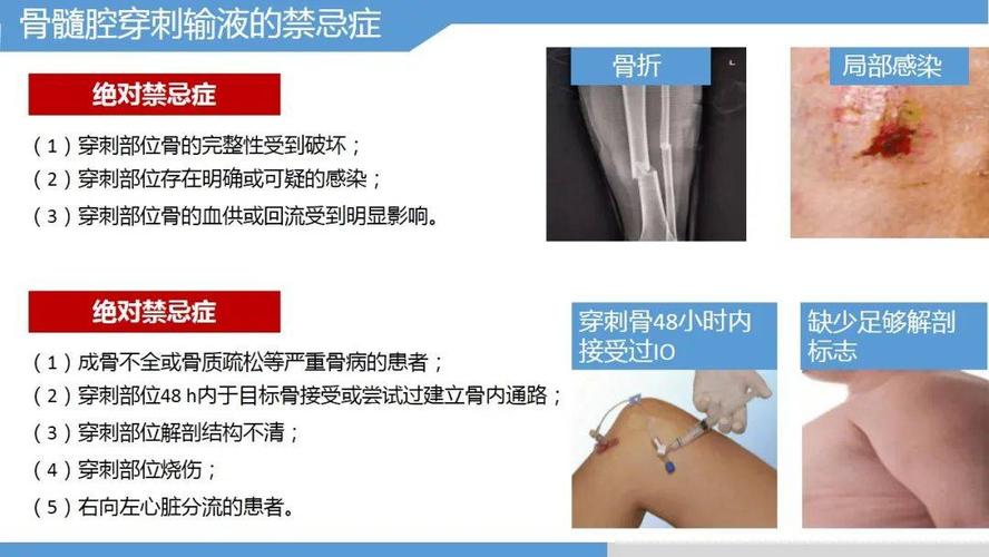 急救输液穿刺技术具体操作教程来了