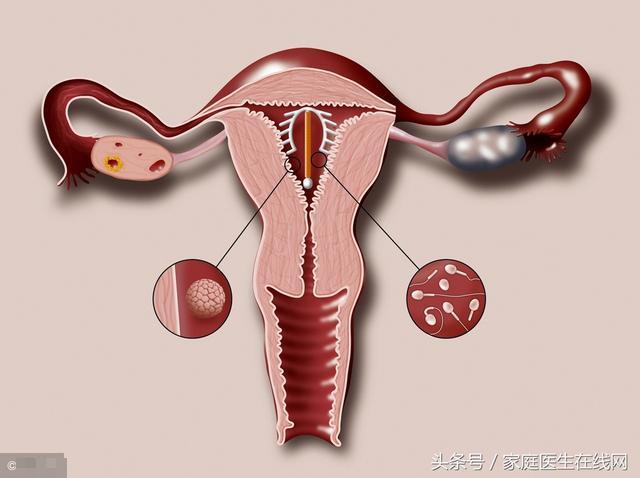 中青看点 健康频道 > 正文   第一就是可能导致子宫穿孔,当然,并不是