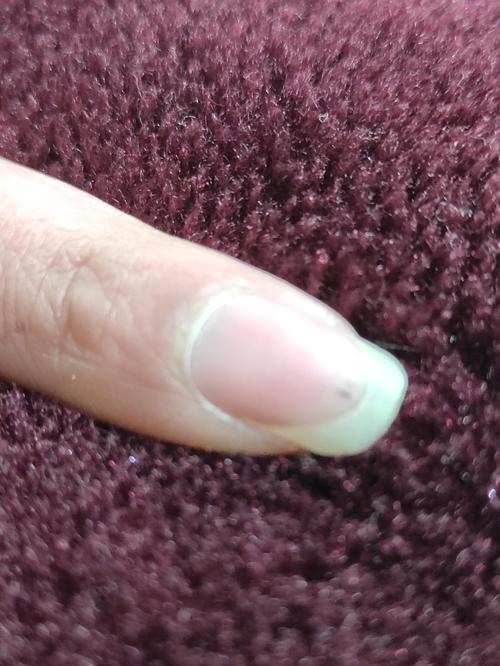 指甲里有一个小黑点是怎么回事呀