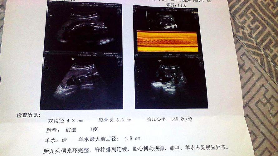 如何辨认胎儿性别?b超数据一眼辨别男女,看完涨知识了!
