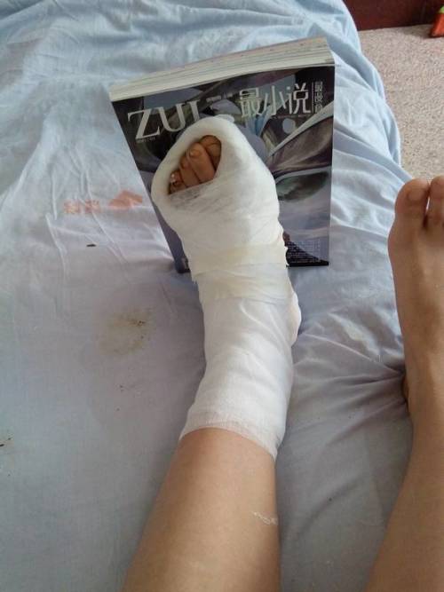 我的左脚第四个脚趾骨折已经半个月,我今年19周岁,我们这有个骨科医院