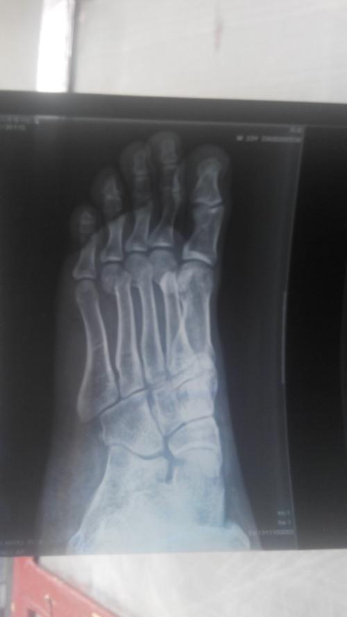 请那位好心的医生进来看下.急急急下图有片子