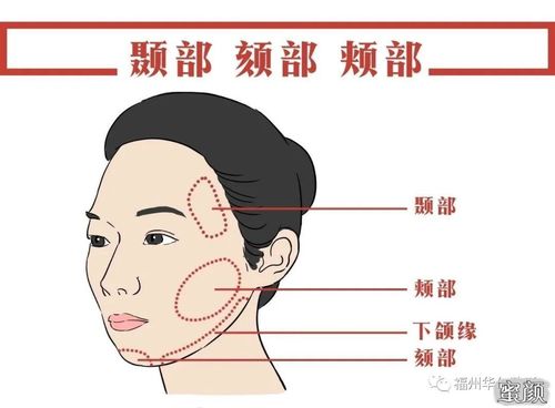 颏部如何调整提升整体气质?