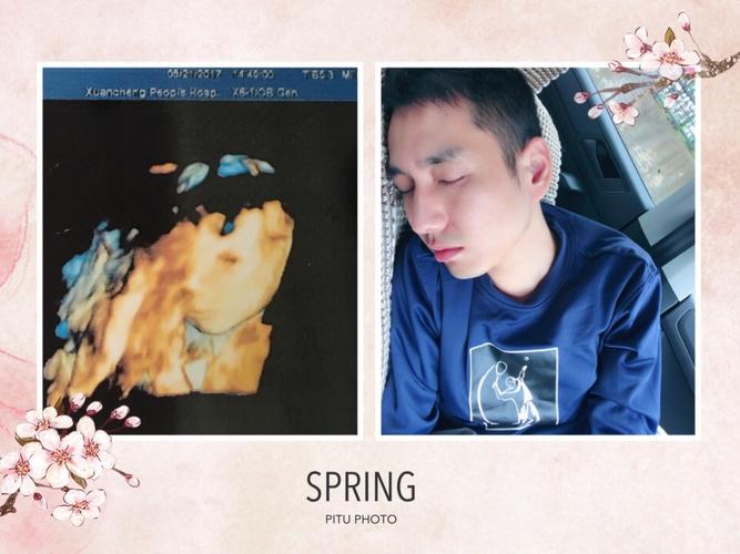 这是四维的照片,和爸爸简直太像了,快看看出生后像谁呀?