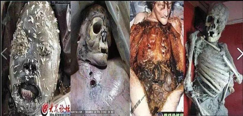 不净观.治贪欲