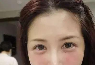 另外,打玻尿酸不疼,会打麻药的.为了美丽这点痛都忍受不了嘛.