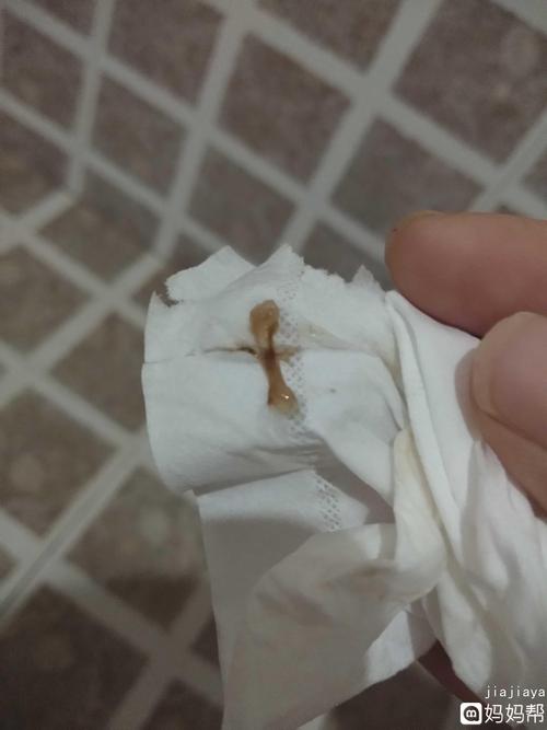 盆腔积液月经期间喝了四天药,姨妈刚走了几天,就流这样的,是不是不