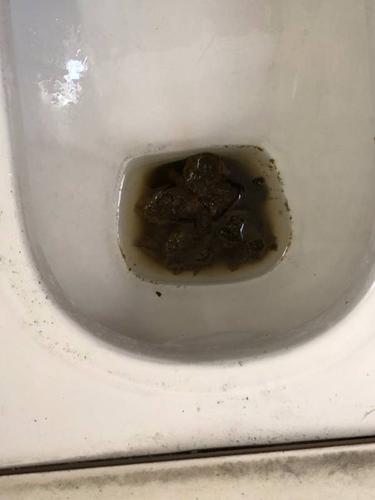 大便又发黑怎么回事