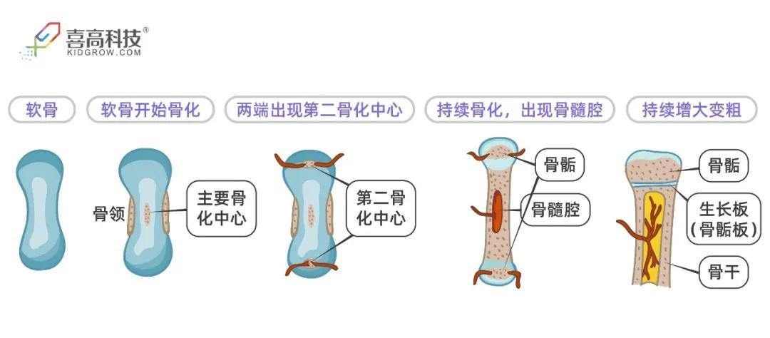 如图,骨骺和骨干中间夹着的一层软骨,就是 生长板(骺板)了.