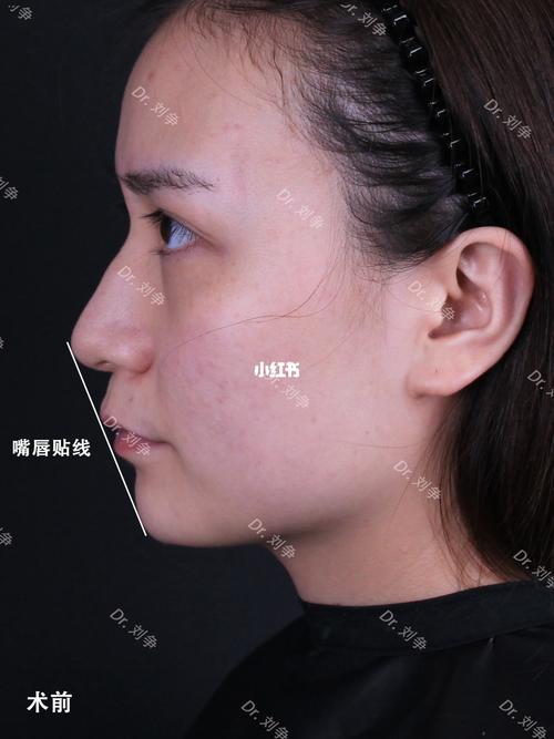 下巴短平71鼻基底凹陷71这点缺陷别怕94_泪沟_法令纹_杭州时光
