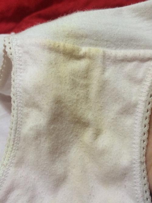 我得内裤最近嘟有黄黄的,是炎症还是正常的分泌物