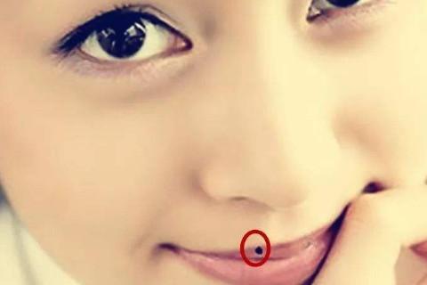 女人嘴唇上痣相图解