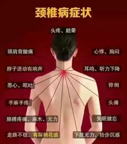 脖子不舒服,肩膀疼,颈肩综合症了解一下