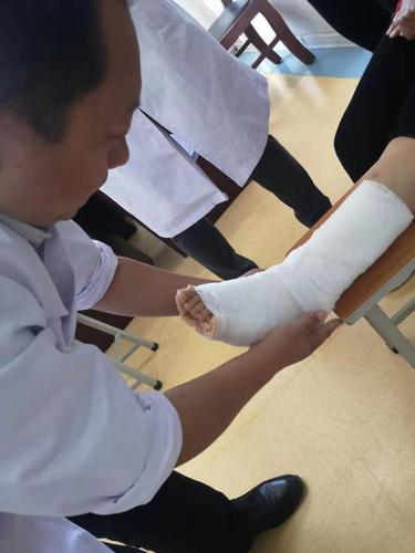 治疗部分病例展示——腓骨下端轻微骨折石膏托外固定