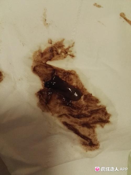 [试管婴儿]帮忙看看这是不是白带,有图慎入