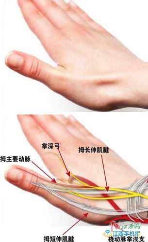 多路通"心" 萍乡市人民医院成功开展远端桡动脉穿刺介入治疗
