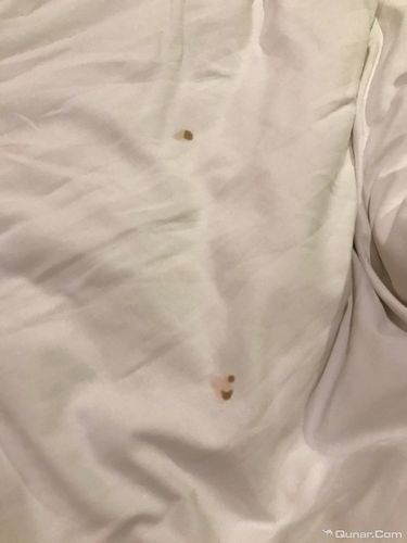 酒店被子有污渍