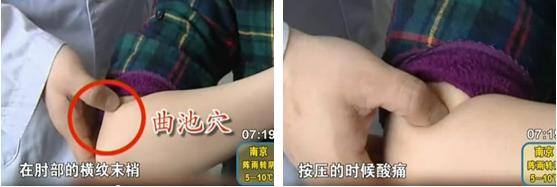 曲池的准确位置图