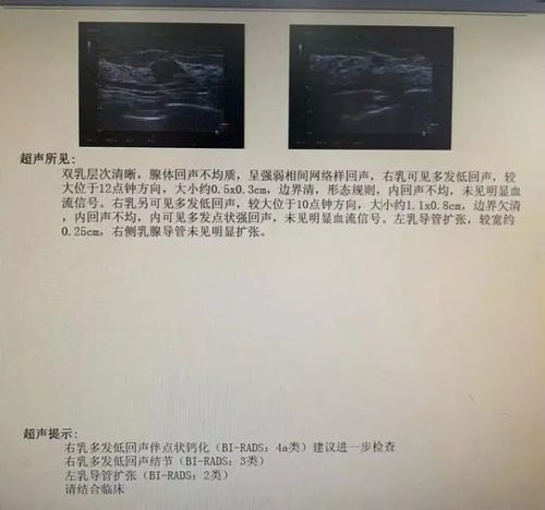 这样的乳腺结节会癌变!不要把小问题拖成大毛病!