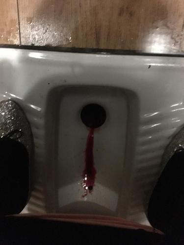 现在一上火就拉血!
