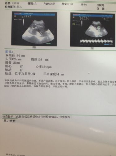 孕16周,四维b超能看清楚胎儿性别吗