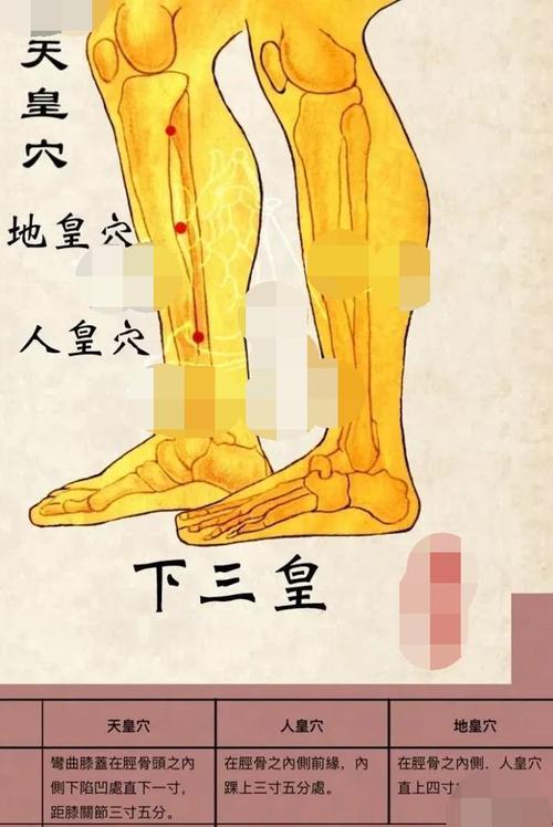 3,针下三皇穴, 效果好.