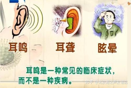 神经性耳鸣是什么问题导致的
