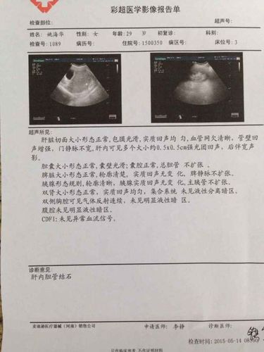 彩超结果说我有胆结石,请帮忙看下是否严重!